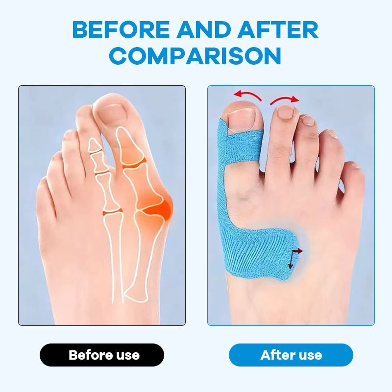 Vorgeschnittenes Kinesiologie-Tape für Hallux valgus